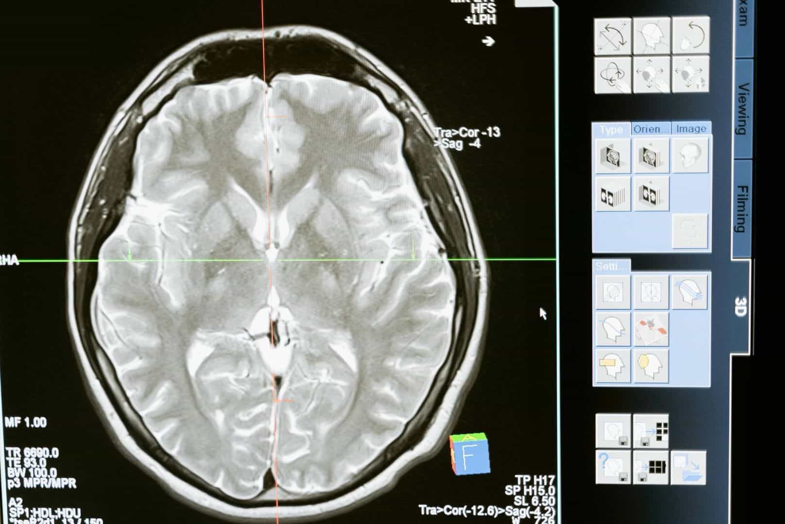 CT scan